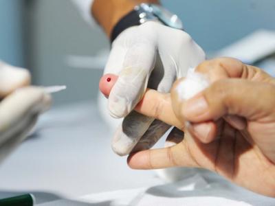 Imagem mostra pessoa fazendo teste de Hepatite